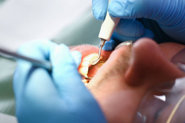 Best Emergency Treatment for Oral Infections in Lacoochee, FL