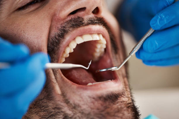 Best Emergency Denture Repair in Lacoochee, FL